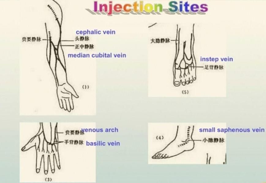 Injection sites