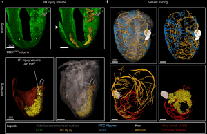 Light Sheet Microscopy vs. Confocal: Which one wins for embryo development tracking?